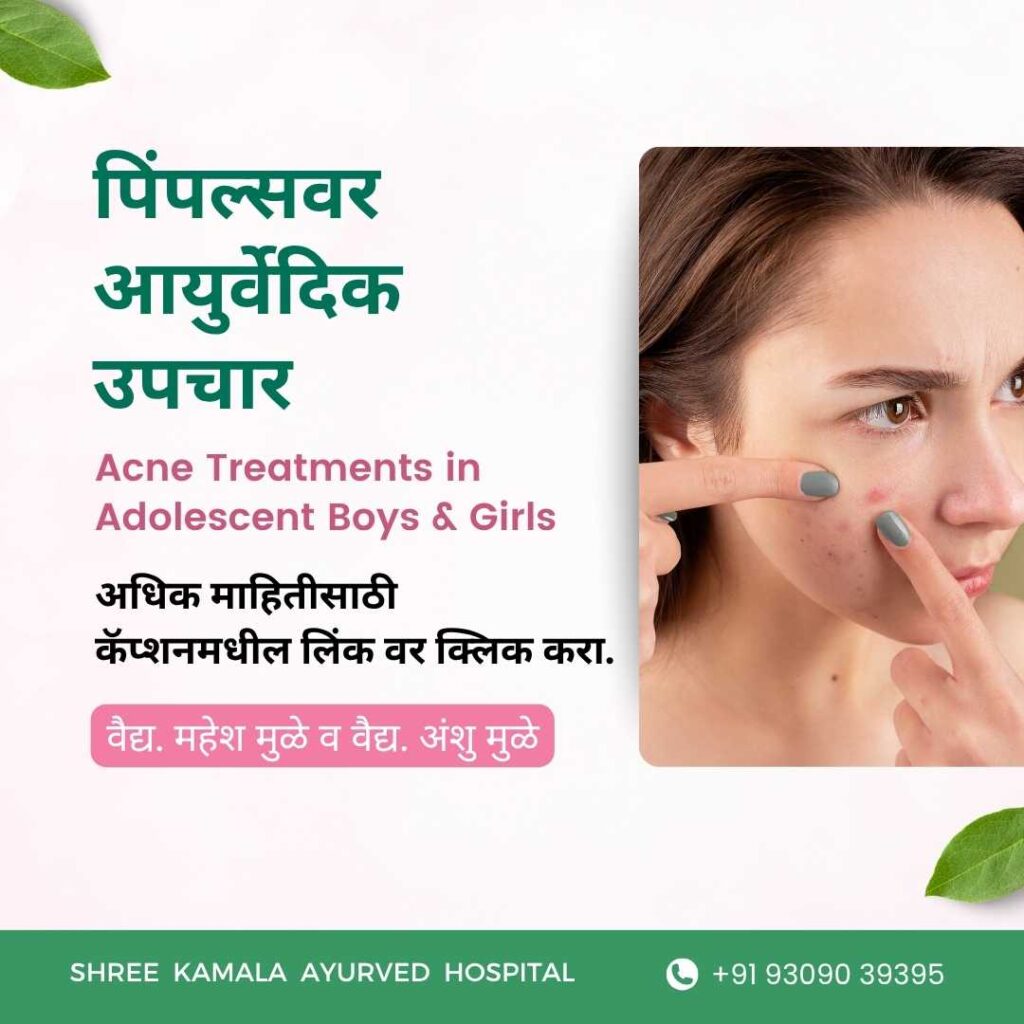 Acne Scar, Pimples treatments in Ahilyanagar पिंपल्सवर उपचार